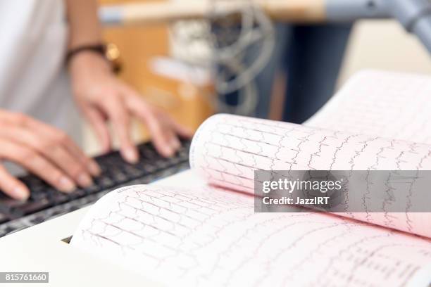 ecg, stress test graph - ritmo-cardíaco imagens e fotografias de stock