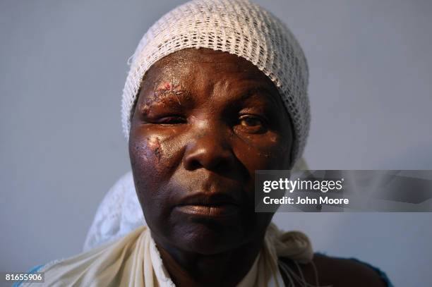 Victim of political violence awaits an x-ray at a clinic June 21, 2008 in Bulawayo, Zimbabwe. She said that she had no political party affiliation,...