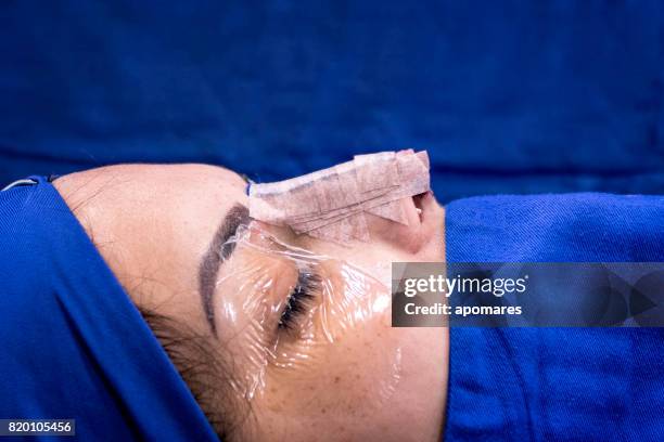 close-up van neus profiel beeld van vrouwelijke patiënt na nasale septun afwijking en rhinoplastie chirurgie. - human nose stockfoto's en -beelden