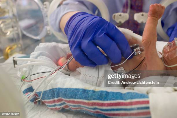 At an undisclosed hospital, a doctor checks on an infant born prematurely on September 15, 2016 in New York City.