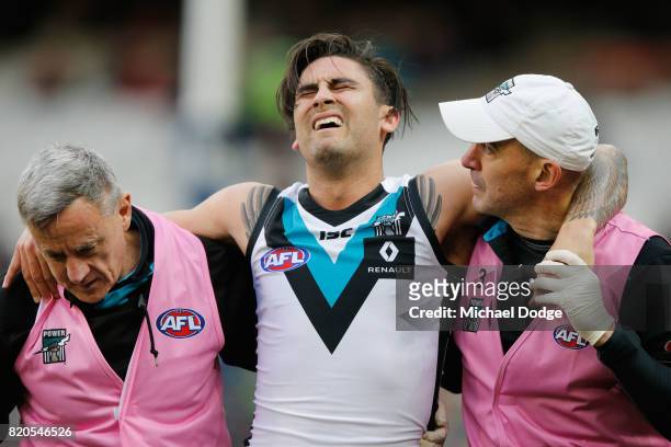 Chad Wingard of the Power is carried off after sustaining a leg injury during the round 18 AFL match between the Melbourne Demons and the Port...