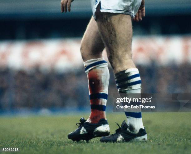 Everton's Peter Reid has sustained an injury to his right leg, with blood clearly showing though his sock, after a heavy tackle during their European...