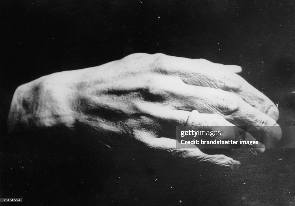 Mould of king Alexander?s hand ( King Alexander I, Yugoslavia) , He was assasinated in Marseille, Photograph, 1934