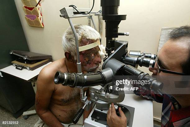 Indian eye surgeon Dharmesh Modi examines injured Soni Hasmukhlal Vrajlal at The Shri C.H. Nagari Municipal Hospital in Ahmedabad on July 31 after he...