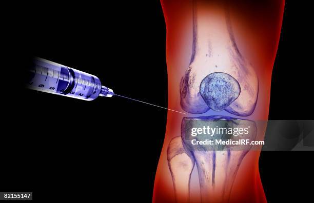 knee injection - knee stock illustrations