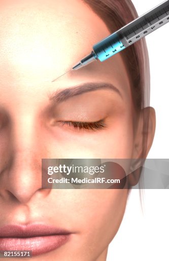 Botox Injection High-Res Vector Graphic - Getty Images