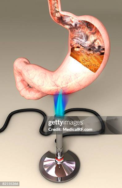 heartburn - gastric acid stock illustrations