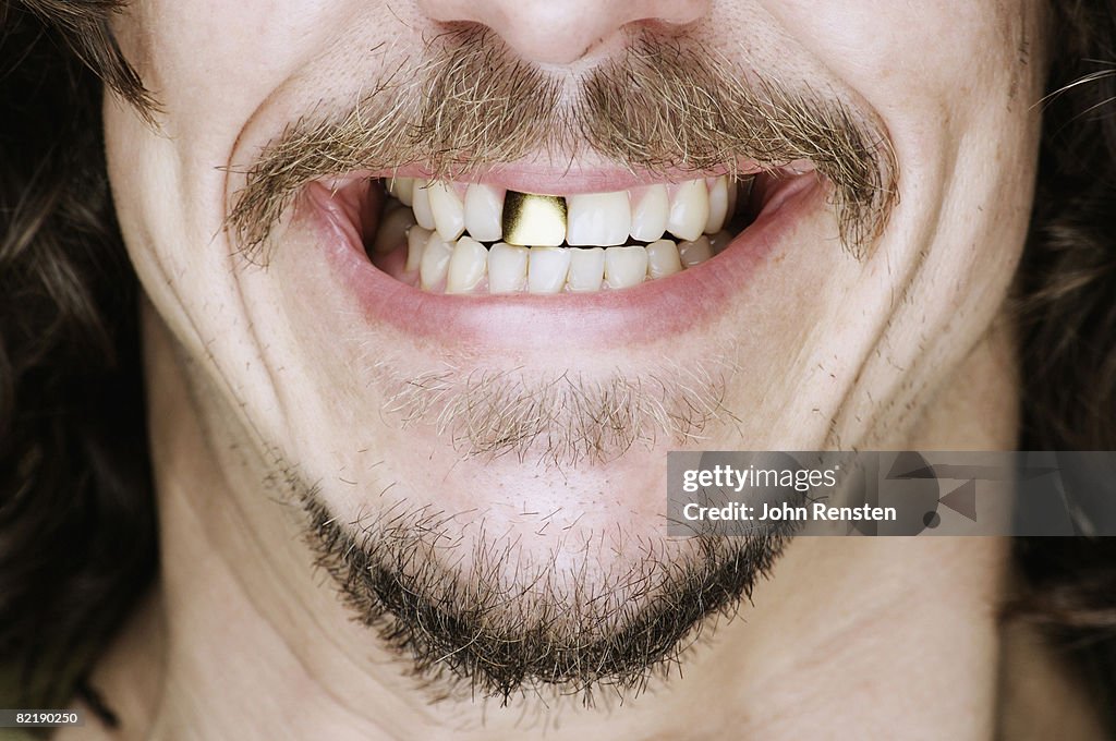 Smiling gold tooth
