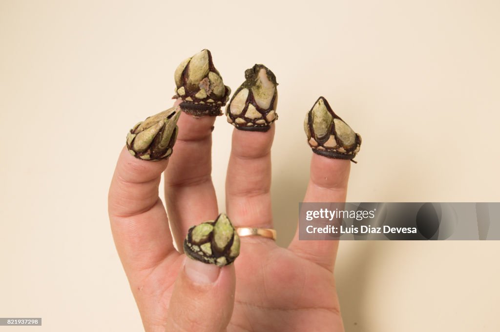 Woman with barnacles on her nails