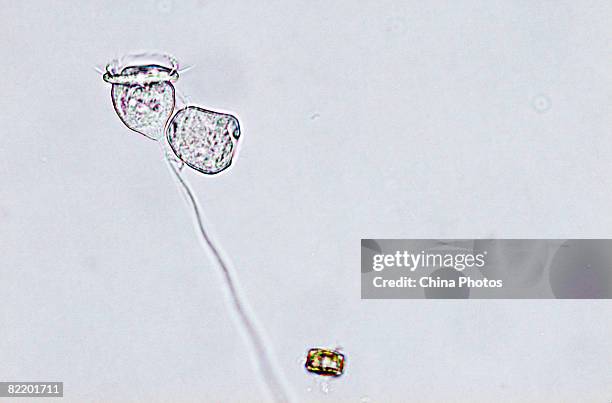 Vorticella cell, seen through a microscope, divides to form new larva in a laboratory of South China Normal University on August 4, 2008 in Guangzhou...