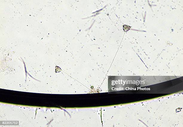 Vorticella cell, seen through a microscope, in a laboratory of South China Normal University on August 4, 2008 in Guangzhou of Guangdong Province,...