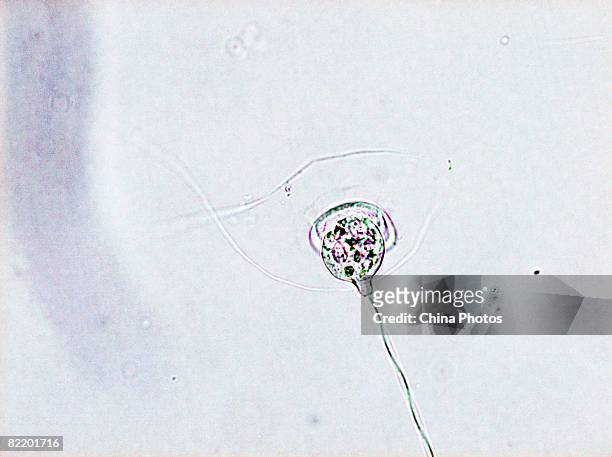 Vorticella cell, seen through a microscope, in a laboratory of South China Normal University on August 4, 2008 in Guangzhou of Guangdong Province,...