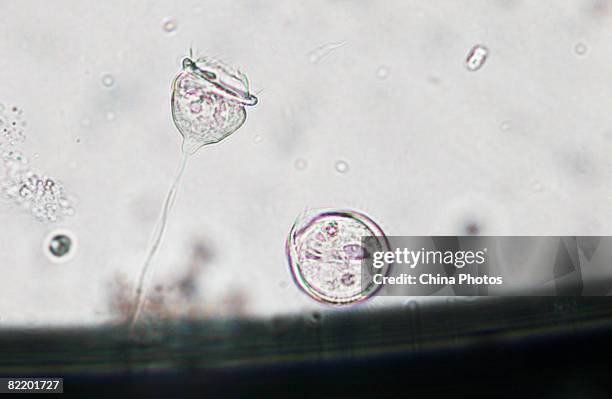 Mature vorticella cell, seen through a microscope, leaves its parent body to grow to be a new vorticella in a laboratory of South China Normal...