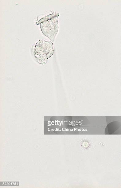Vorticella cell, seen through a microscope, divides to form new larva in a laboratory of South China Normal University on August 4, 2008 in Guangzhou...