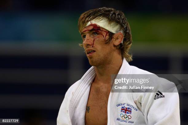 Craig Fallon of Great Britain is seen with a bandage around his head after he defeated Younes Ahmadi of Morocco in their 60 kg repechage judo bout...