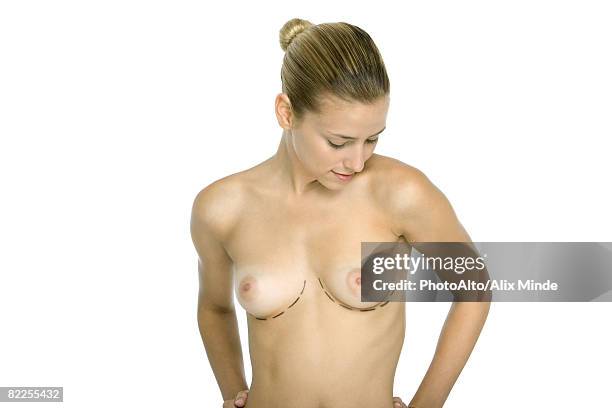 nude woman with plastic surgery markings under breasts, looking down - aumento dos seios imagens e fotografias de stock