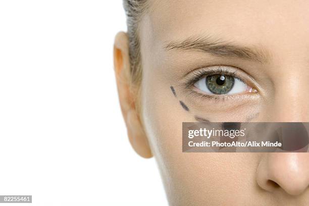 young woman with plastic surgery markings under eye, cropped view - schönheitsoperation stock-fotos und bilder