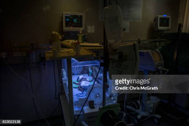 Newborn baby suffering complications is seen in an incubator in the neonatal unit at Shifa hospital on July 19, 2017 in Gaza City, Gaza. In the past...