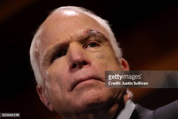 Sen. John McCain looks on during a news conference to announce opposition to the so-called skinny repeal of Obamacare at the U.S. Capitol July 27,...