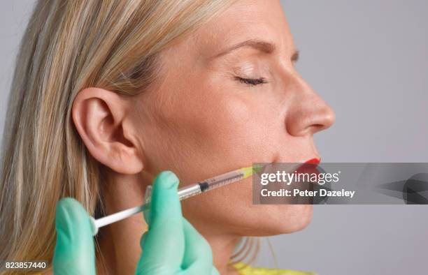woman having botox injection into her face - botox face stock pictures, royalty-free photos & images
