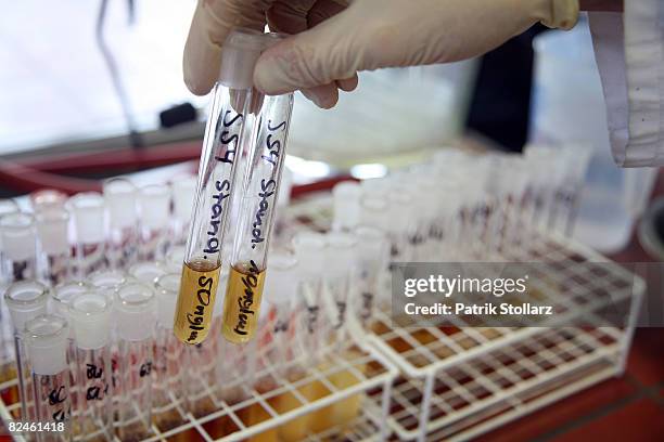 Labratory technician works at the Doping Control Laboratory of the Biochemical Institute at the University for Sports on August 19, 2008 in Cologne,...