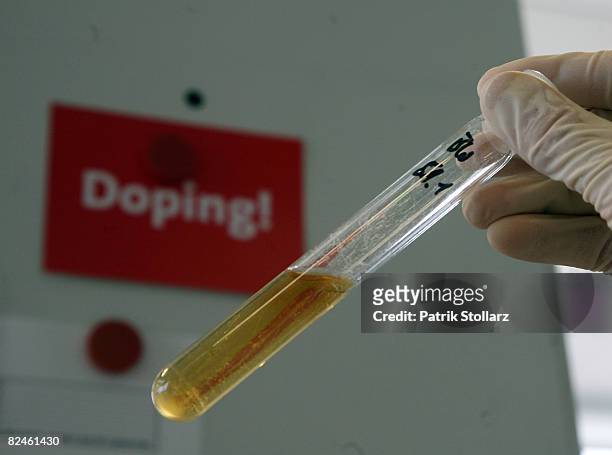 Labratory technician works at the Doping Control Laboratory of the Biochemical Institute at the University for Sports on August 19, 2008 in Cologne,...