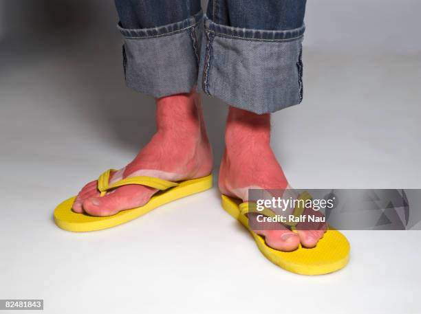 portrait of feet with sunburn - sunburnt stock pictures, royalty-free photos & images