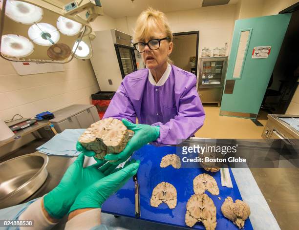 Dr. Ann C. McKee, Director of Boston University's CTE Center and Chief of Neuropathology at the VA Boston Healthcare System, does an autopsy on the...