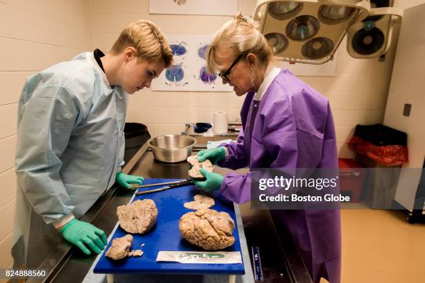 Dr. Ann C. McKee, Director of Boston University's CTE Center and Chief of Neuropathology at the VA Boston Healthcare System, right, and Research...