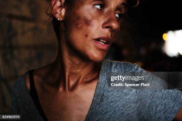 Samantha, a homeless heroin addict, pauses under a bridge where she lives with other addicts in the Kensington section of Philadelphia which has...