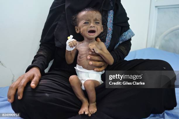 Saleh is four months old and suffers from severe acute malnutrition. He weighs 2.5 kg and was admitted to the hospital on April 14th. His 22-year-old...