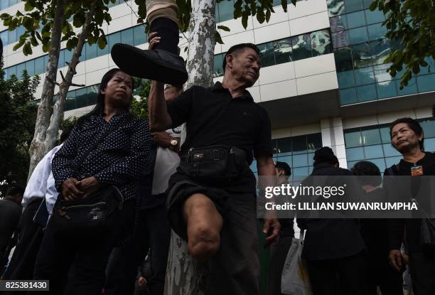 Tee Sae Tiew who lost his leg during a crackdown on "Yellow Shirt" protesters in 2008, holds up his prosthetic leg whilst speaking to the media...