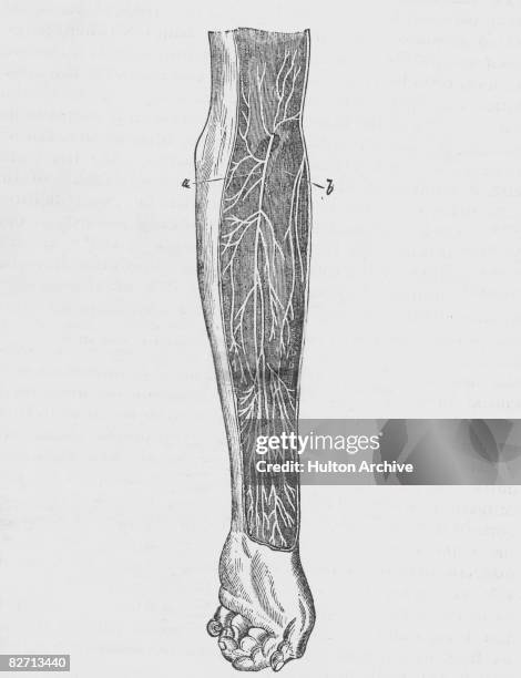 An anatomical diagram of a human arm, cut away to show the musculo-cutaneous nerve piercing the fascia of the arm just above the elbow, and a branch...