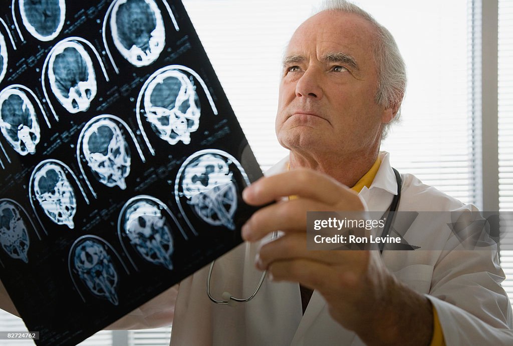  Senior doctor looking at mri x-rays