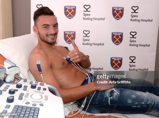West Ham United New Signing Sead Haksabanovic undergoes his medical at Spire Roding Hospital on August 7, 2017 in London, England.