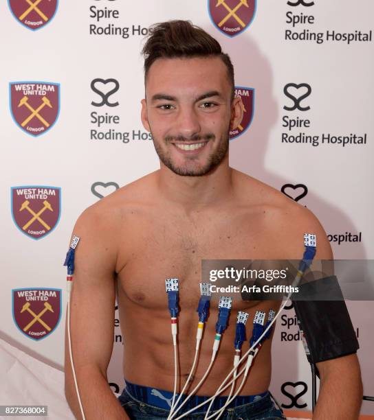 West Ham United New Signing Sead Haksabanovic undergoes his medical at Spire Roding Hospital on August 7, 2017 in London, England.