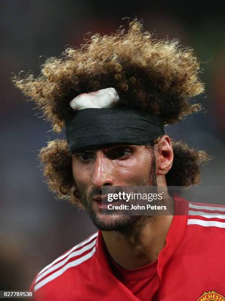 Marouane Fellaini of Manchester United shows the after effects of a head injury during the UEFA Super Cup match between Real Madrid and Manchester...