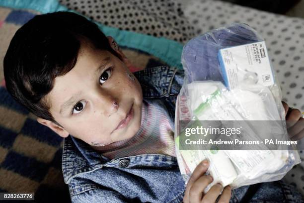 Young boy suffering from leishmaniasis, a disease transmitted by sand flies, at the Maywand Hospital in Kabul, Afghanistan, Wednesday December 14...