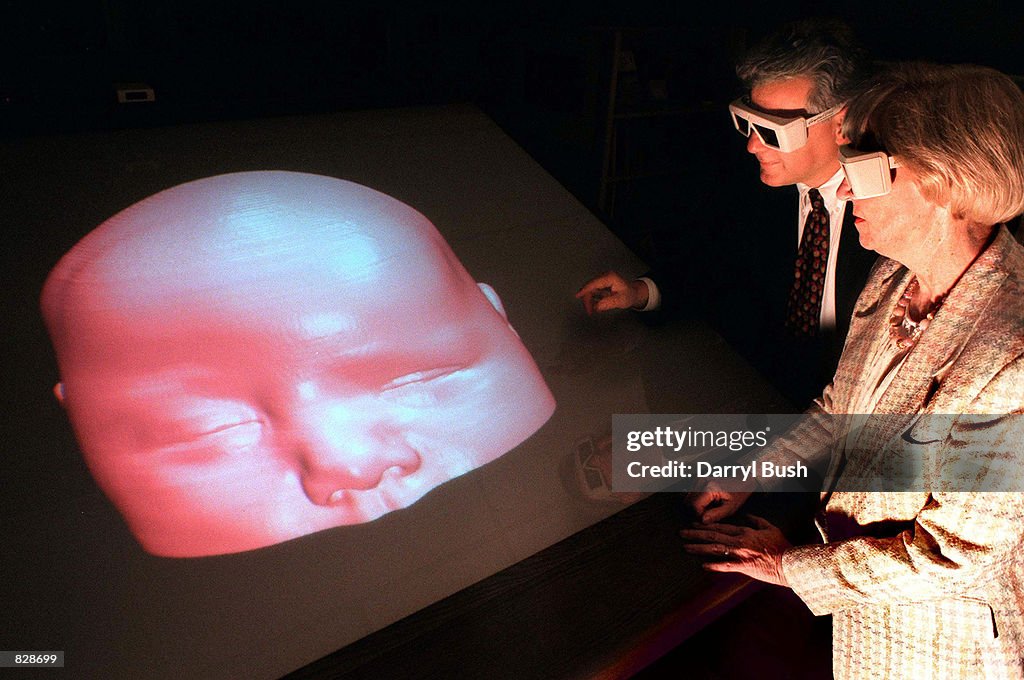3-D image of a baby's head