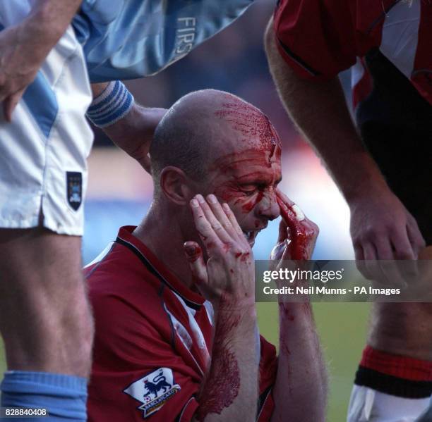 Southamptons Chris Marsden after colliding with Jihai Sun, during the Barclaycard Premiership match at the St Mary's Stadium, Southampton, THIS...