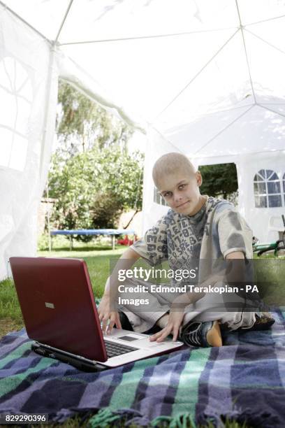 Joshua Hartley sits under the protective shade of a gazebo in his garden in Romsey, Hampshire, as he begins, his recovery from a life-saving bone...