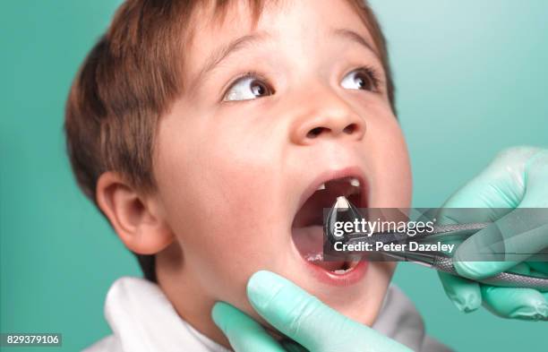 dentist pulling childs tooth - extraction forceps stockfoto's en -beelden