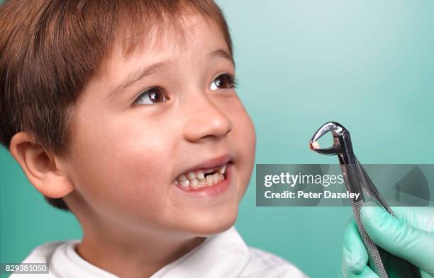 young boy having tooth extracted by dentist - extraction forceps stockfoto's en -beelden