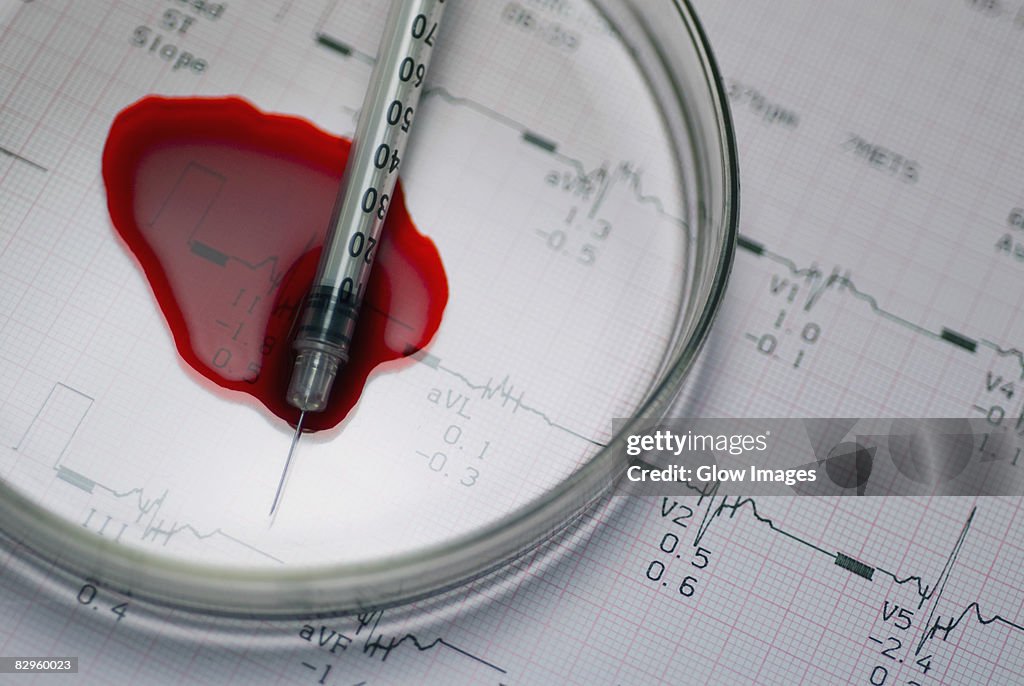 Close-up of a syringe and magnifying glass on a medical report