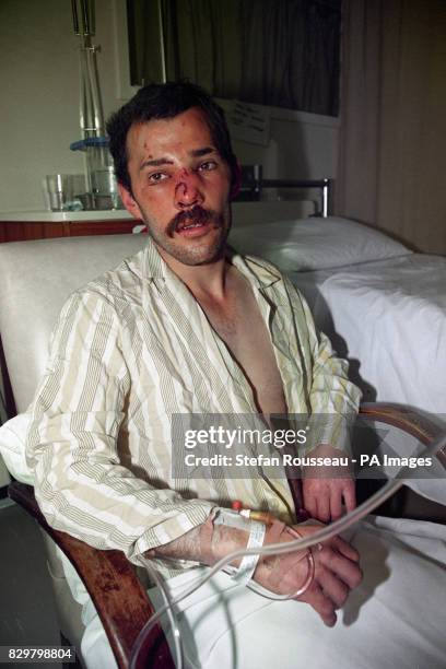 William Devlin Rmt 140 Shankill Road Bombing Stock Photos, High-Res Pictures, and Images ...