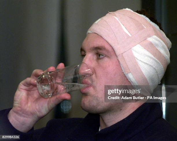 Bandaged London Scottish rugby player, Simon Fenn, takes a sip of water during a news conference held today following an incident at last Saturday's...