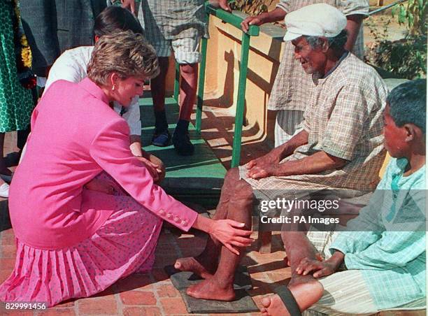 File dated 4.3.93 of Diana, Princess of Wales visiting a leprosy hospital in Kathmandu. The Prince of Wales today placed a comforting hand on one of...