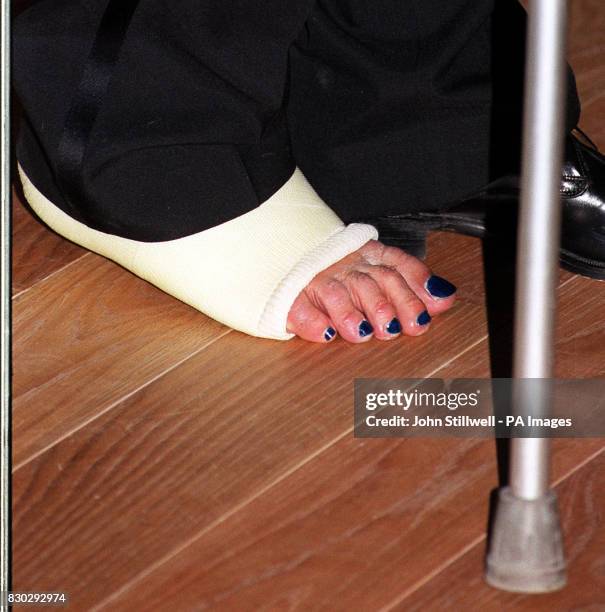 The plastered foot of Jeremy Dixon, one of the three architects responsible for the redevelopment of the Royal Opera House, which opened with a Royal...