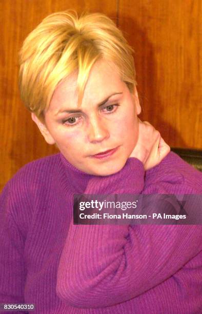 Nursery nurse Lisa Potts at a press conference in London, after learning that she will be awarded a total of 49,000 in compensation for her injuries...