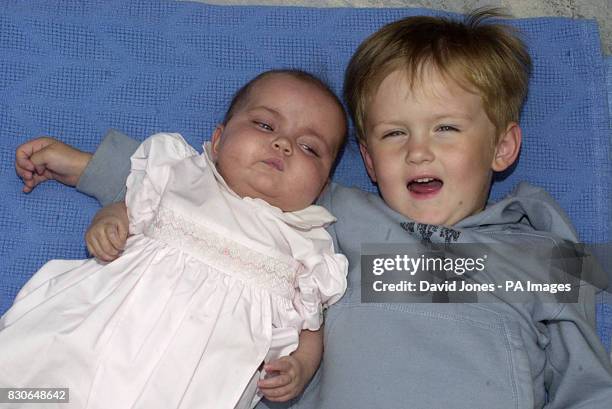 Seven-month-old Freya Stratford pictured with her brother, Adam at the Diana, Princess of Wales Children's Hospital in Birmingham, before going home...